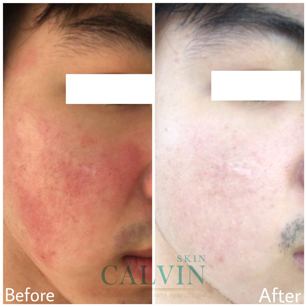 Moist-Reborn-Cleanser-before-after-02