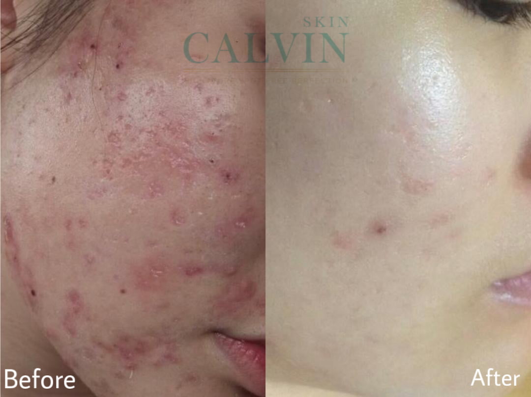 Skin-Recover-Toner-before-after-01