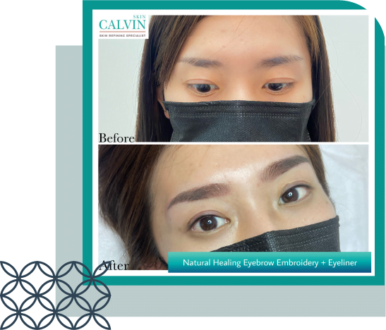 Calvin-Skin-Signature-Natural-Healing-Cosmetic-Surgery